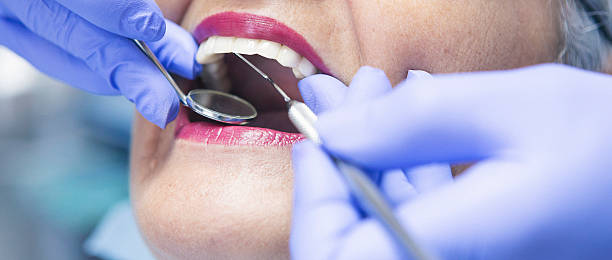 Best Emergency Treatment for Dental Infections or Abscesses in Aromas, CA